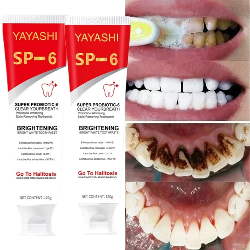 Probiotic Whitening Toothpaste