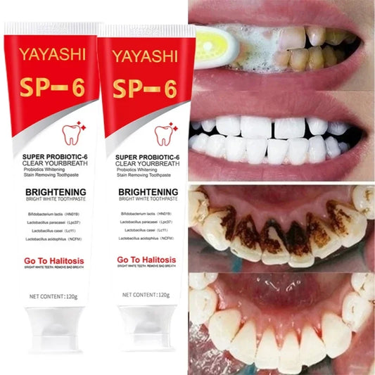 Probiotic Whitening Toothpaste